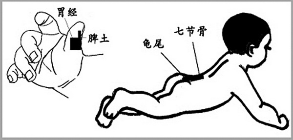 小儿便秘推拿