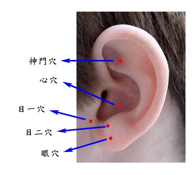 多多按摩耳上穴道可减缓儿童近视度数加深。