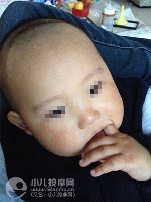 小儿推拿调理幼儿湿疹案例图片15