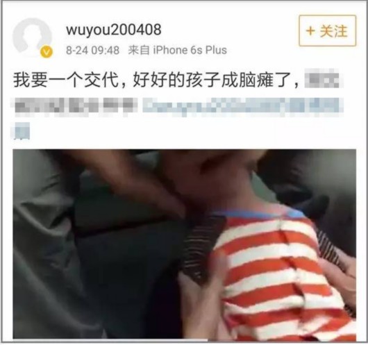 小儿推拿与脑瘫